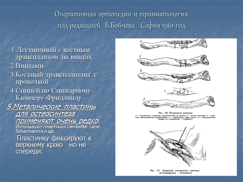 Оперативная ортопедия и травматология под редакцией Б.Бойчева София 1961 год 1.Лестничный с костным трансплантом